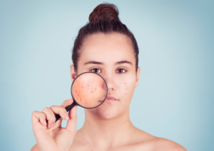 mynutriplan_diet_akmi
